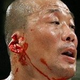 Illustration for article titled Rope Takes Fighters Ear